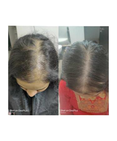 Ancient Wisdom Hair Care Oil - Achieve Healthy Shiny Problem-Free Hair | International Shipping Available - Buy Online on GoSupps.com