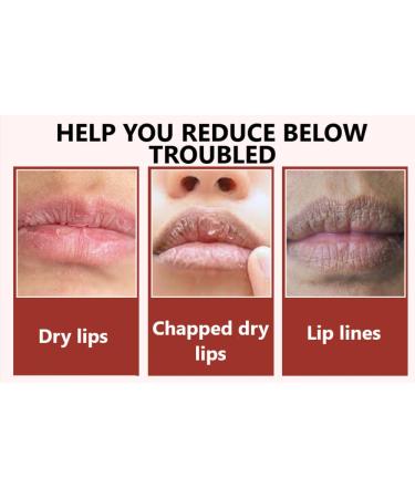 Buy Sugar Lip Scrub - Gentle Exfoliator & Moisturizer for Dry Lips | Best Lip Care Online - Buy Online on GoSupps.com