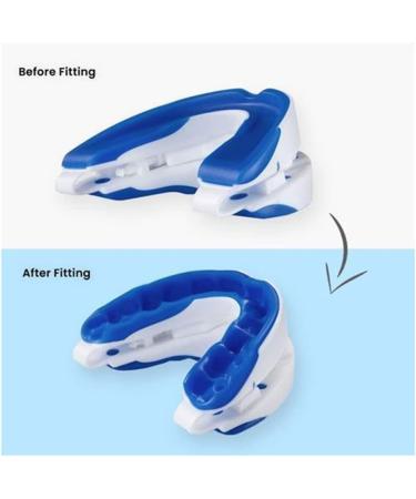 Snore Stopper Mouthpiece | Adjustable Snoring Solution for Men & Women | Prevent Bruxism & Improve Sleep Quality | Bias&Belief - Buy Online on GoSupps.com