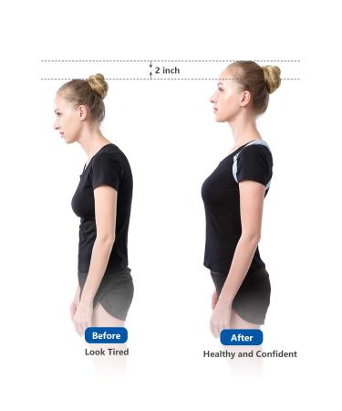 CHILIKI Posture Corrector & Trainer with Intelligent Sensor Vibration Reminder - Adjustable Upper Back Brace for Men, Women, Kids | Universal Size - Buy Online on GoSupps.com