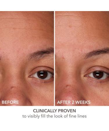 Dr Dennis Gross DermInfusions Fill + Repair Serum - Instant Line Filler & Skin Plumper 1 oz | International Shipping Available - Buy Online on GoSupps.com