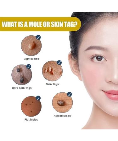 (Must - Have) Super Luxe Skin Re_mover Super Luxe Skin Re_moval Skin Tag Re_mover Cream Painless Mole and Skin Re_mover for All Skin Types (2PC) - Buy Online on GoSupps.com