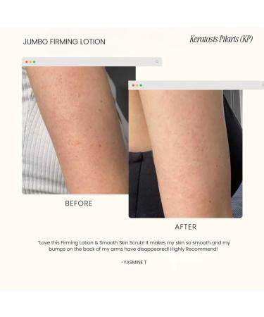 Firming Body Lotion - Hydrating Skin Moisturizer for Smoother Toned and Nourished Skin Lightweight Daily Cream for All Skin Types - (5.07fl.oz) - Fragrance Free - Buy Online on GoSupps.com