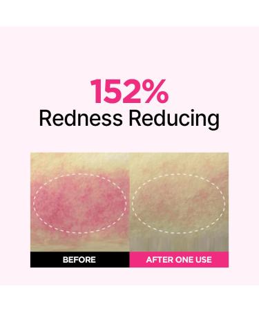 ISOI Blemish Care Up Facial Serum Triple Set Korean Skin Care Set for Glass Skin Radiance 2 Full Size & 1 Refill Eye & Wrinkle Patch Tester Daily Hydration Skincare Gift for Women (2.13 fl. oz) Triple Set (2.13 fl.oz) - Buy Online on GoSupps.com