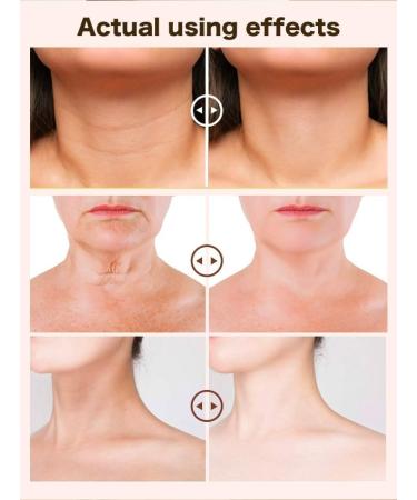 EXQST Double Retinol Anti-Wrinkle Neck Cream Retinol Neck Cream for Fine Lines Double Retinol Neck Cream Lighten Neck Lines Firm Neck Skin - Buy Online on GoSupps.com