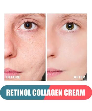 Buy Retinol Cream with Hyaluronic Acid - Anti-Aging Day-Night Moisturizer for Men & Women | Reduces Wrinkles & Dryness - 1.78 Oz - Buy Online on GoSupps.com