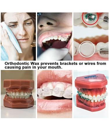 Angzhili 10 Pack Dental Orthodontics Wax for Brace Wearers Gum Protection (Multi-Color) - Buy Online on GoSupps.com