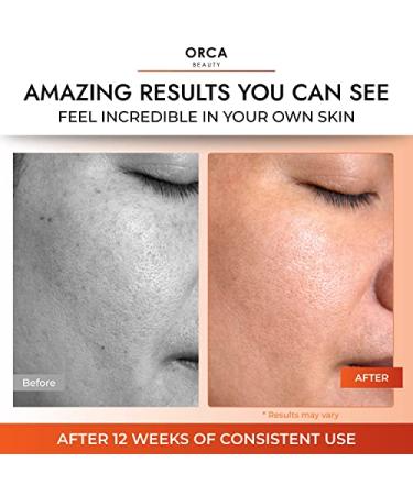 Vitamin C Serum for Face with Hyaluronic Acid - Brightening Skin Serum - Buy Online on GoSupps.com