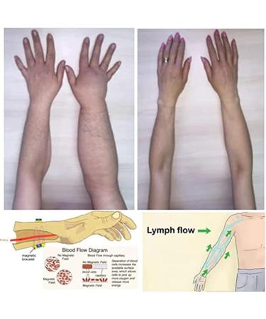 Supyini Magnetic Lymphatic Drainage Bracelet Detoxify & Boost Energy | Perfect Gift - Buy Online on GoSupps.com