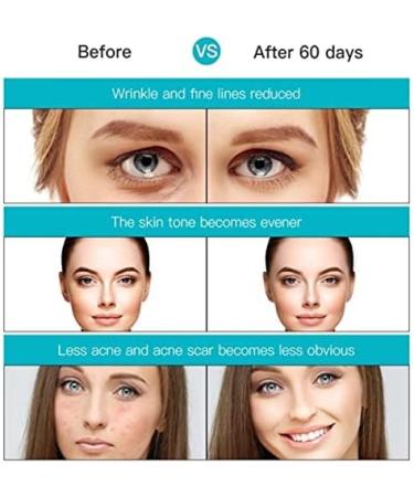 obqo Led Face Mask-7 Color Photon Red Blue Light Therapy for Skin Rejuvenation Treatment | Home Light Therapy Facial Care Mask - Buy Online on GoSupps.com