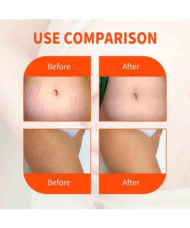 Optimal Oil Collagen Boost Body Oil | Firming & Lifting Skincare | Hydrating and Moisturizing | Removes Stretch Marks | 2 Bottles - Buy Online on GoSupps.com