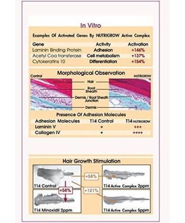 Nutrigrow Anti Hair Loss & Faster Hair Growth Shampoo Dry & Normal Hair - Buy Online on GoSupps.com