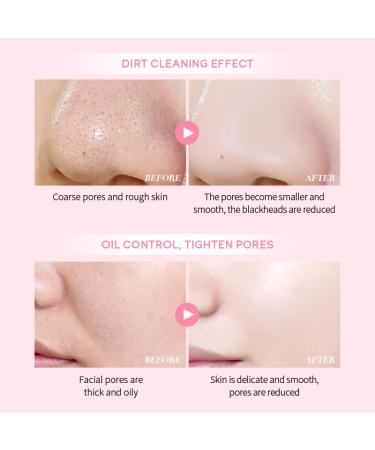 AKARY Sakura Clay Facial Mud Mask - Deep Cleansing Pore Minimizer Oil Control & Acne Reduction - Natural Skin Care for Youthful Skin - Buy Online on GoSupps.com