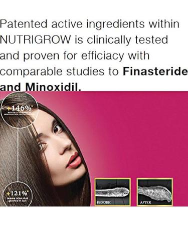 Nutrigrow Anti Hair Loss Conditioner for Faster Hair Growth - Buy Online on GoSupps.com