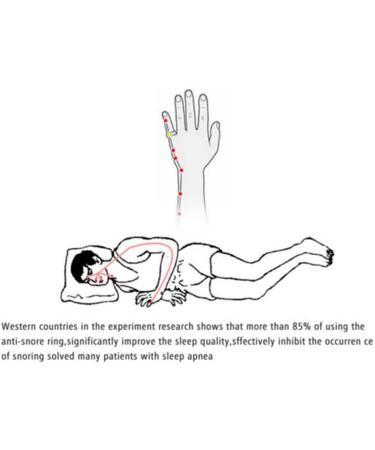 Anti Snoring Ring - Acupressure Treatment for Improved Breathing - 3 Sizes (S) - Men, Women, Children - Anti Snore Device - Buy Online on GoSupps.com
