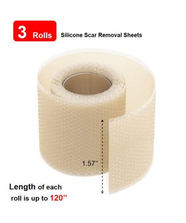 IGOOLEE Silicone Scar Sheets Strips Tape - 3 Reusable Rolls for Surgical Scar Removal - 1.57 x 120 Size - Ideal for Keloid & C-Section Scars - Buy Online on GoSupps.com