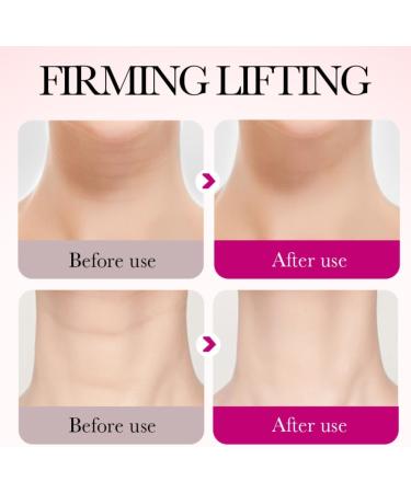 Neck Firming Cream Lifting and Tightening Neck Cream with 3X Hexapeptide Collagen Retinol - Smooth Wrinkles Reduces Neck Lines - 50g - Buy Online on GoSupps.com