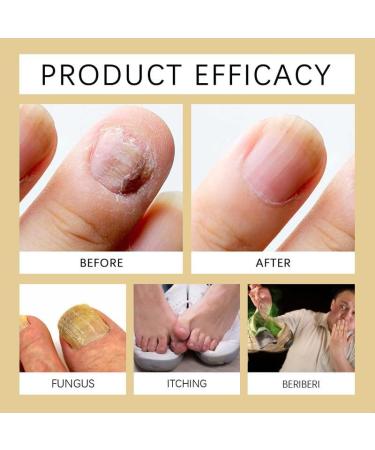 Huile De Soin Des Ongles La K Ratine Huile Pour Ongles Et Cuticules La K Ratine - Hu/ile R Paratrice Hydratante Et Fortifiante Pour Les On/gles Hui/le Pour O/ngles Et Cuticules (2 PCS) - Buy Online on GoSupps.com