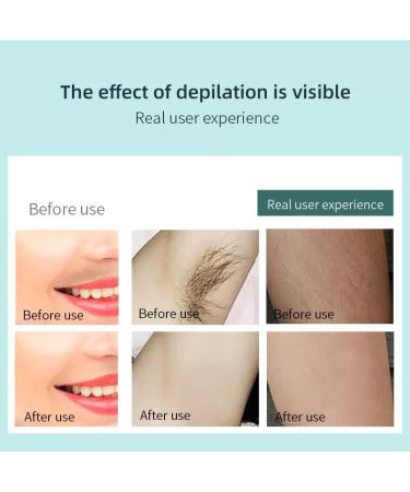 Crystal Hair Remover: Safe, Portable Epilator for Men and Women - Painless Hair Removal and Exfoliation - Buy Online on GoSupps.com