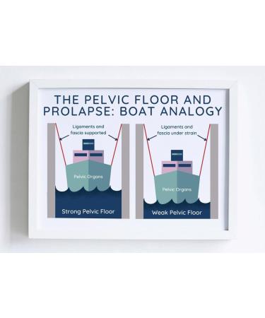 Pelvic Floor Physical Therapist Poster Pelvic Floor And Prolapse Pelvic Floor Physical Therapy Womens Health Physical Therapy Womens Health Horizontal Poster And Canvas