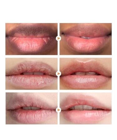Magic Lip Lighten Scrub - Dark Lip Removal Exfoliate & Brighten for Moisturized Pink Lips - Buy Online on GoSupps.com