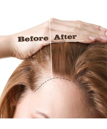 EBIN NEW YORK Hair Oil - 100% Natural Peppermint Rosemary & Lavender | Triple Strength 60ml | Soothing & Stimulating Formula - Buy Online on GoSupps.com