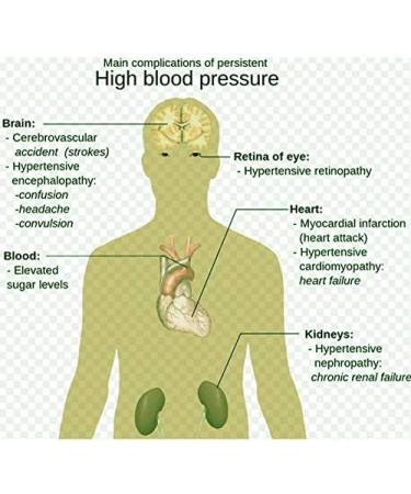 Herbal 100% Natural Lowering Blood Pressure Heat transdermal Patch for Hypertension (3 Boxes) 42 Patches - Buy Online on GoSupps.com