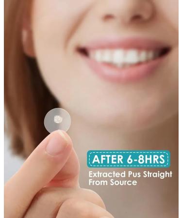 Tristar Beauty Miracle Acne & Pimple Cover 24 Effective Healing Patches for Clear Skin | Fast International Shipping - Buy Online on GoSupps.com