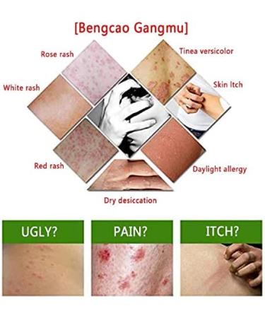 Biaoyun 10pcs Dermatitis & Rash Relief Cream Set - Soothes Itching & Inflammation, External Use - Buy Online on GoSupps.com