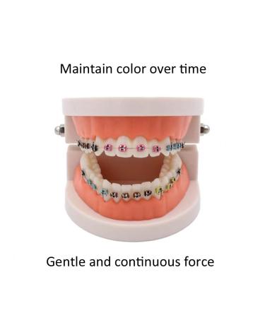 1040 O-Rings | Clear Orthodontic Elastomeric Ligature Ties for Braces | Elastic Rubber Bands for Orthodontic Brackets - International Shipping - Buy Online on GoSupps.com
