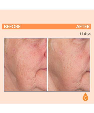 Serious Skincare Vitamin C Face Cream - Hydrating Anti-Aging Moisturizer for All Skin Types with SPF 30 - 2 Fl Oz - Buy Online on GoSupps.com