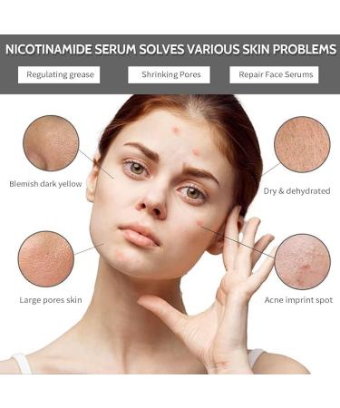 Niacinamide Powder Dark Spot Remover for face Spot Brightening Skincare Niacinamide Skincare Powder Dry and Oils skin Moisturiser Face Minimises Pore Reducer Discoloration Correcting powder - Buy Online on GoSupps.com