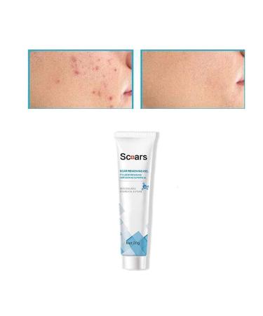 PICKX Organic Scar Removing Gel Keloid Scar Removal Cream for Surgical Scars Old Scar for Lightening Scars and Acne Marks Suitable for Sensitive Skin (1PC)