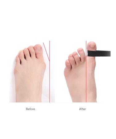 Brrnoo Bunion Toe Straightener & Corrector Strap - Toe Separator for Flexibility Training and Alignment Restoration - Buy Online on GoSupps.com