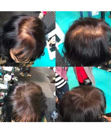 Hair Building Fibers 50g - Thicker Fuller Hair for Men & Women | Waterproof Hair Powder | 6 Shades Available (Blonde - Buy Online on GoSupps.com