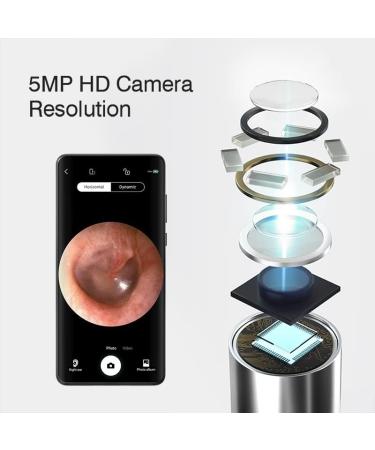 Wireless Ear Wax Removal Kit with Camera | 6 LED Lights | Compatible with iPhone, iPad, Android | Ear Cleaning Tool - Buy Online on GoSupps.com