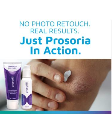 Prosoria Psoriasis Treatment System - Clinical Strength with Natural Botanicals | Soften, Restore & Treat Skin | 2 Fl Oz (Pack of 2) - Buy Online on GoSupps.com