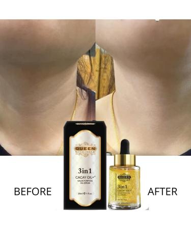 QUEEN 3in1 CACAY OIL++ Galactomyces Time Rejuvenate Intense Oil Face Serum (30ml/1fl.oz) - Buy Online on GoSupps.com