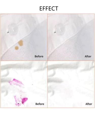 Stain Remover Pen - Wash Free Bleach Pen for Clothing | Remove Coffee Food Red Wine & Lipstick Stains | 3 Pack - Buy Online on GoSupps.com