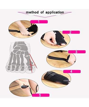 Buy Effective Bunion Corrector & Splint | Pain Relief for Hallux Valgus & Hammer Toe - International Shipping Available - Buy Online on GoSupps.com