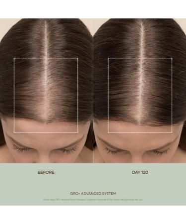 VEGAMOUR GRO+ Advanced Balancing Shampoo - Exfoliating & Cleansing for Thinning Hair Color Safe Vegan & Cruelty-Free (8 Fl Oz - Buy Online on GoSupps.com