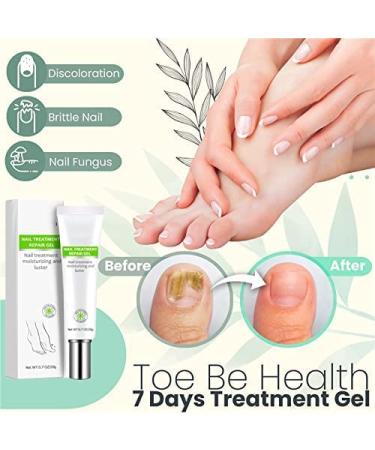 JFGO TOE Be Health 7 Days Treatment Gel & Efero Nail Repair Essence Gel - Instant Toenail Treatment & Cure | Nail Repair Cream (2PC) for Healthy Nails - Buy Online on GoSupps.com