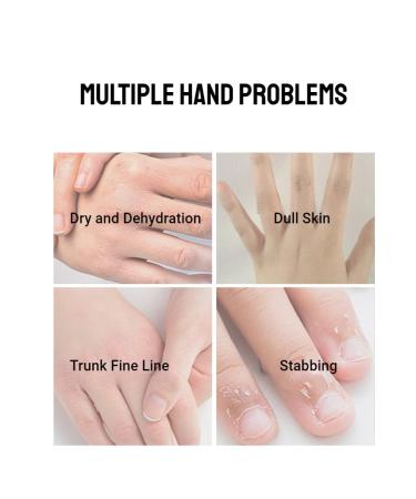 50g Moisturizing Hand Cream - Remove Dead Skin & Nourish Damaged Hands | Repair & Smooth Cracked Skin - Ideal for Nursing - Buy Online on GoSupps.com