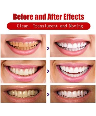 Yangyangda Adjustable Snap-On Tooth Replacement | Temporary Tooth Veneers for Confident Smiles - Upper Teeth Restoration - Buy Online on GoSupps.com