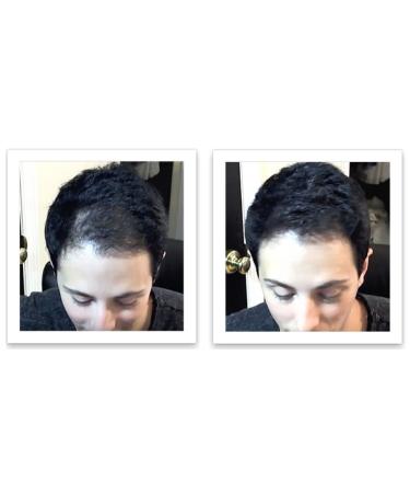 Caboki Plant-Based Hair Concealer - Covers Bald Spot & Thinning Hair - Black (16G) - Buy Online on GoSupps.com