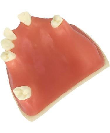 Samnuerly Education Model Toy - Upper Jaw Teeth Model for Sinus Lift & Implant Restoration (40mm) | Premium Dental Educational Tool - Buy Online on GoSupps.com