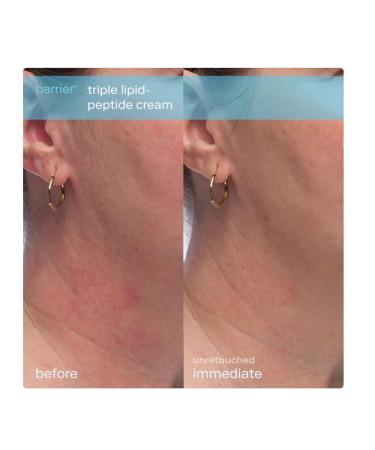 Skinfix Barrier+ Triple Lipid-Peptide Refillable Face Cream 1.7 oz - Hydrating Skin-Loving Formula for All Skin Types | Shop Internationally - Buy Online on GoSupps.com