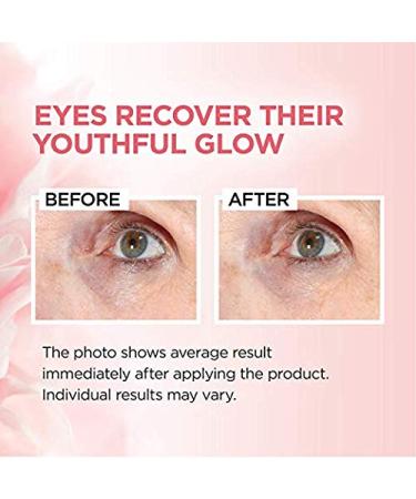 Age Perfect Rosy Tone Eye Brightener Cream | Correct Dark Circles | Fragrance & Paraben Free | 0.5oz (Pack of 2) - Buy Online on GoSupps.com