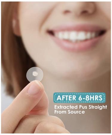 Acne Pimple Patch Master Patch - 144 Hydrocolloid Dots for Effective Blemish Treatment | International Shipping Available - Buy Online on GoSupps.com