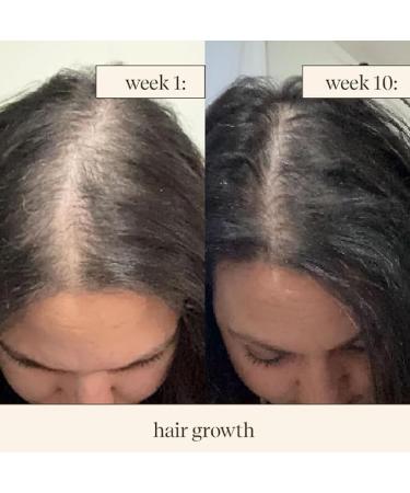 inde wild Champi hair oil 50 ml with Brahmi Amla and Bhringraj Ayurvedic Hair Growth Oil for Dandruff Hair Fall and Thicker Fuller Hair 16+ Ayurvedic Actives Calming scent - Buy Online on GoSupps.com